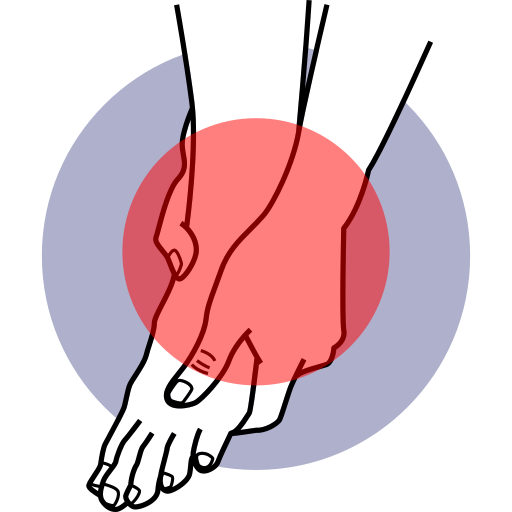 Bunion Feet Pain
